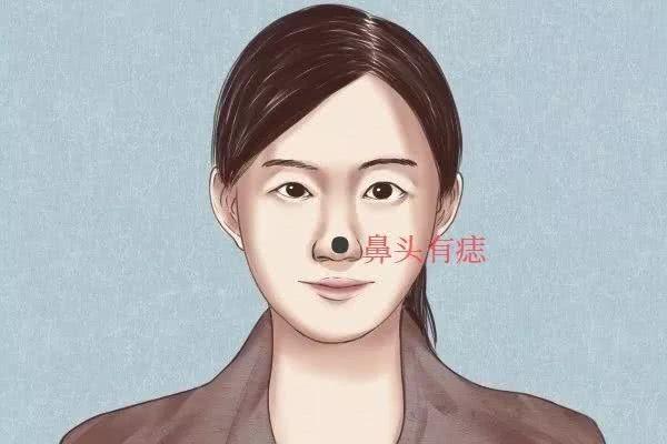 解析女人脖子痣相与生活运势的关联