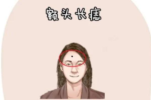 从额头上的痣看女人的性格与人生运势