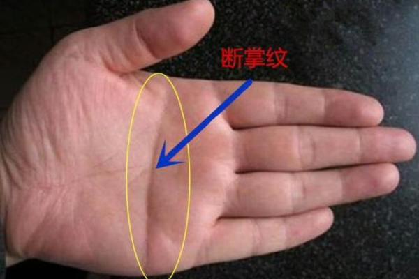 女人手部痣相解析：从手掌看出人生运势