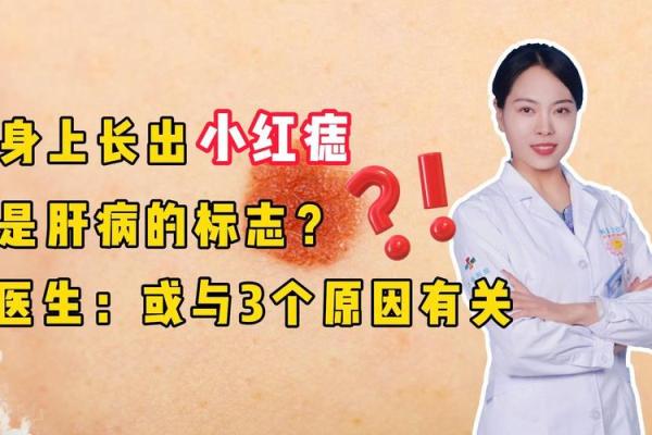 红痣在女生身上的寓意与解析