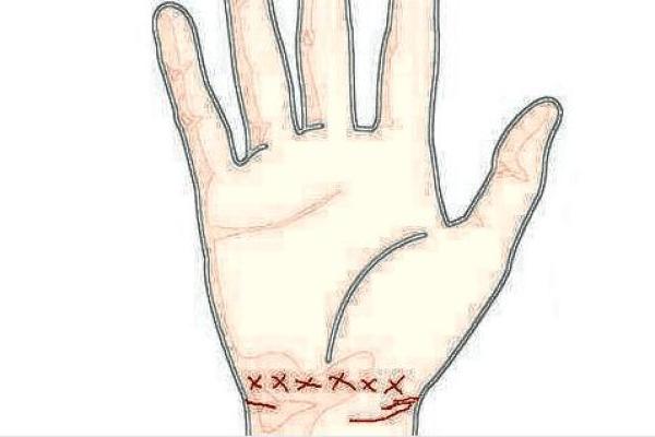 流产手相揭秘:这些细节预示着什么? 流产手相揭秘:这些细节预示着什么?