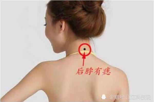 不容忽视的痣相：脖子上的痣，预示着什么运势？