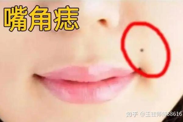嘴角痣:财运亨通的神秘印记 嘴角痣:财运亨通的神秘印记