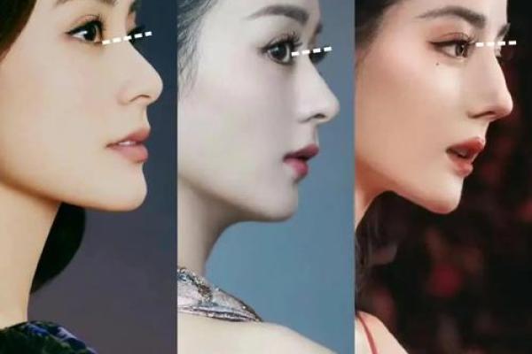 山根突起:揭秘女性面相中的高贵气质象征 山根突起:揭秘女性面相中的高贵气质象征