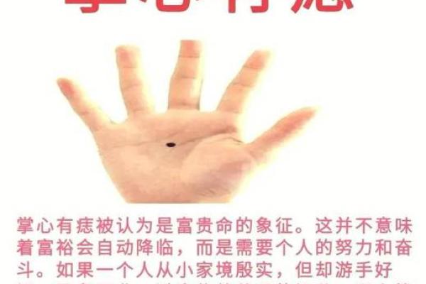 看痣识财运,揭秘天生富贵男的特征! 看痣识财运,揭秘天生富贵男的特征!