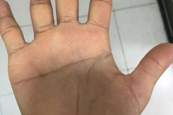 犀角头面相揭秘：洞察命运与性格的秘密