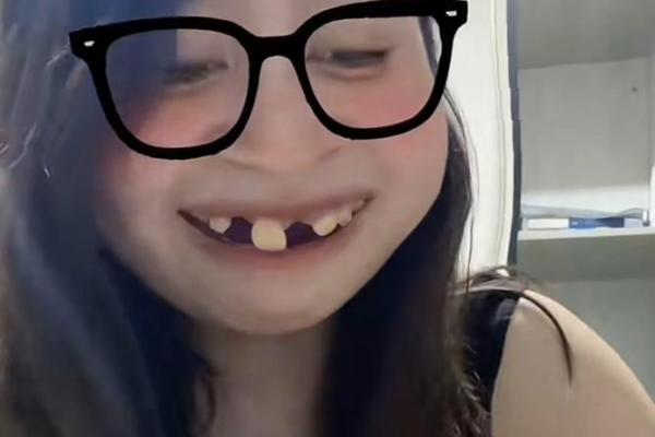 门牙掉落，笑颜依旧？揭秘颜值逆袭的秘密！